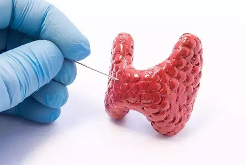 甲状腺疾病，包括甲状腺功能减退和甲状腺功能亢进，自古以来就是反复被医学研究人员研究的疾病