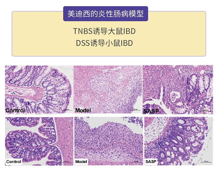 J9九游会老哥俱乐部的炎性肠病模型.png